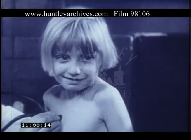 Malnutrition In Children In London 1930s Film 98106 1930 